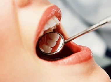 1 «Smile Spa» - лучший выбор для лечении и реставрации зубов